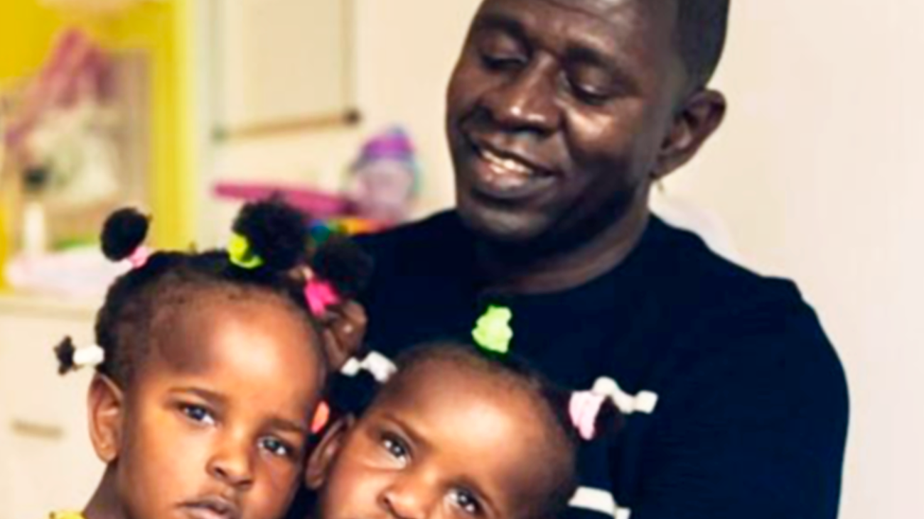 El dilema de un padre de dos siamesas