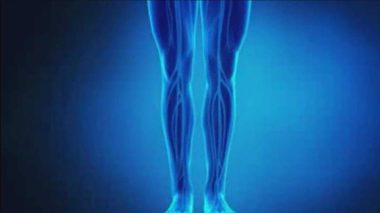 Consejos para evitar las piernas hinchadas