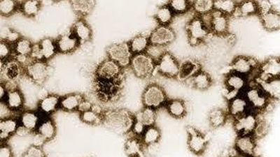 Fallece una anciana de 90 años por listeriosis en Andalucía