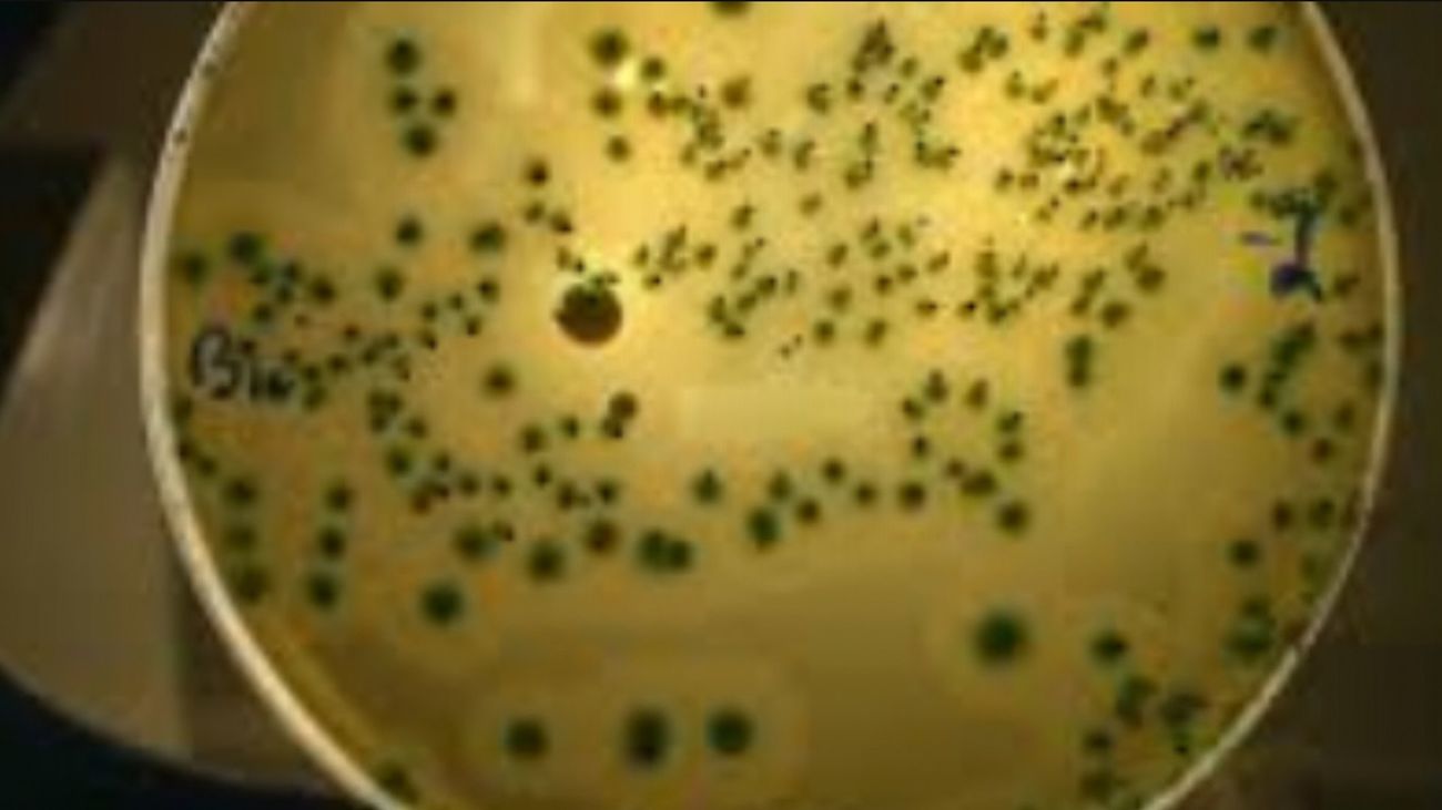 Se estudia un posible caso de listeriosis en Madrid