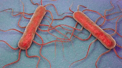 Seis sospechas de listeriosis en Madrid, incluido un bebé que está ingresado