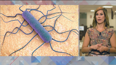 Los expertos advierten que con la listeria, lo único efectivo es la prevención