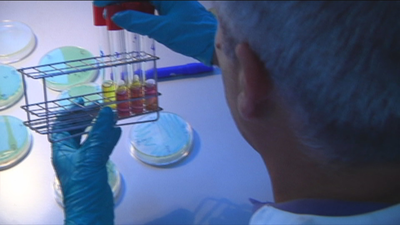 España en alerta por listeriosis