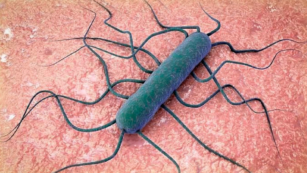 Nuevos casos de listeriosis en Madrid