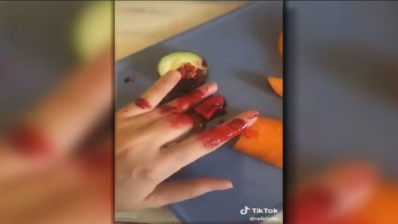 Una madre finge haberse cortado un dedo para dar un susto a sus hijos