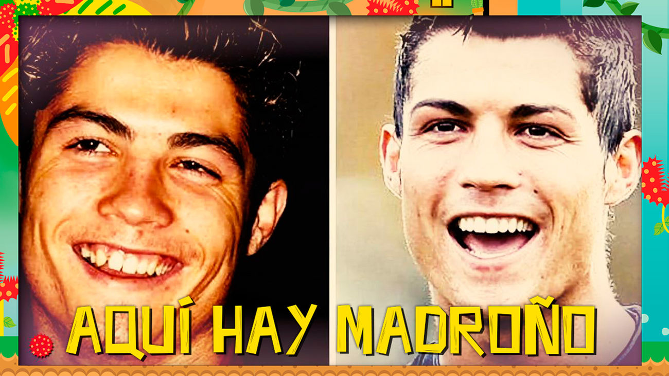 Cristiano Ronaldo, un apasionado de la cirugía estética