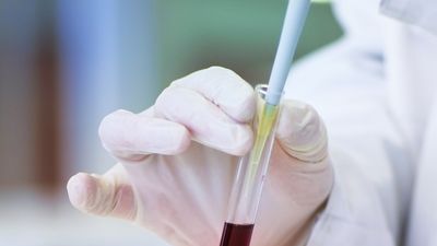 Los hospitales madrileños necesitan con urgencia sangre del grupo B-