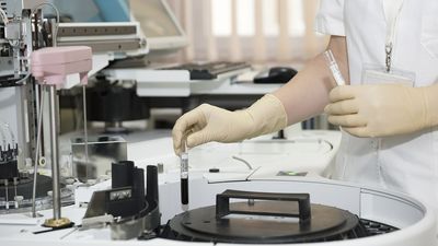 La clave contra la leucemia mieloide aguda podría estar en los antihistamínicos