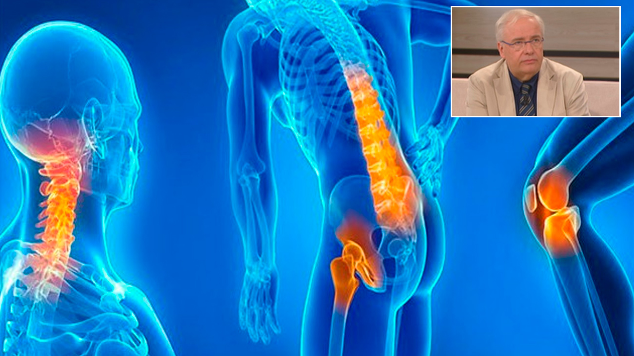 Descubre cómo prevenir y tratar la artrosis