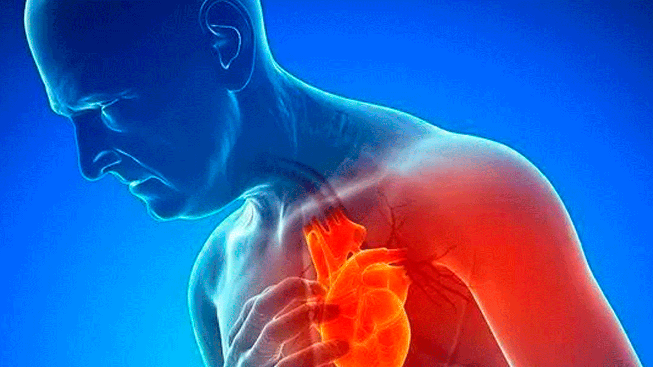 Síntomas de un infarto en mujeres y hombres