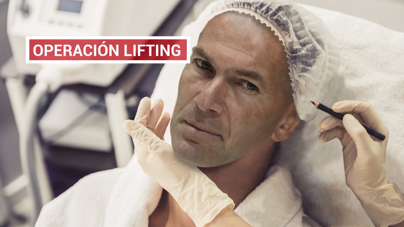 Cirugía estética en el Real Madrid