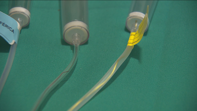 Patentan un sistema inequívoco para la administración de medicinas por vía venosa