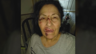 Una anciana sufre una brutal caída en un bache 'trampa' de Tetuán