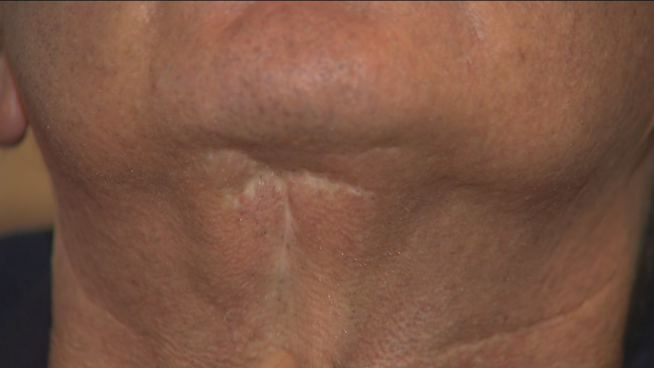 Condenan a Vitaldent tras taladrarle la carótida a un cliente