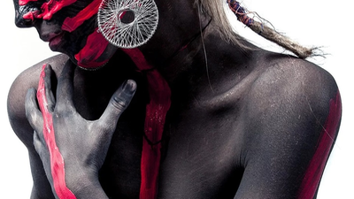 Cómo cuidar tu piel si tienes psoriasis