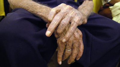 Un infectado por un brote de sarna en una residencia de Arganda del Rey