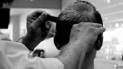 El trasplante capilar no cura la alopecia