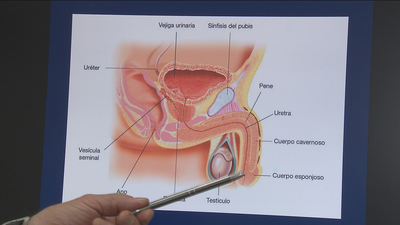 Aumentar el grosor del pene está de moda en Madrid