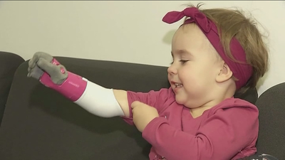 Así es la nueva prótesis revolucionaria por su ligereza