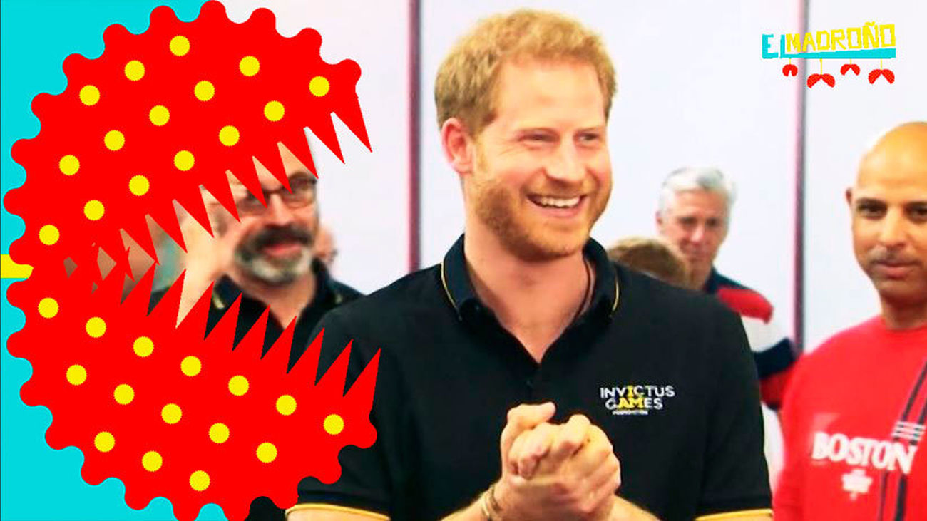 Los retoques estéticos del Príncipe Harry