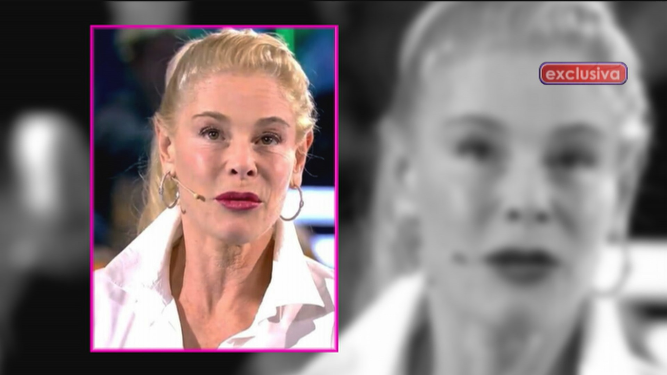 ¿Qué se ha hecho Belén Rueda en la cara?