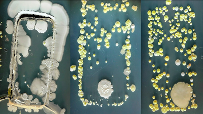 Los móviles acumulan más bacterias que los inodoros