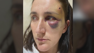 Así acaba tras tropezar con una baldosa en mal estado de Collado Villalba