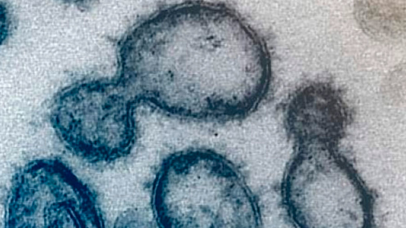 Coronavirus saliendo de una célula