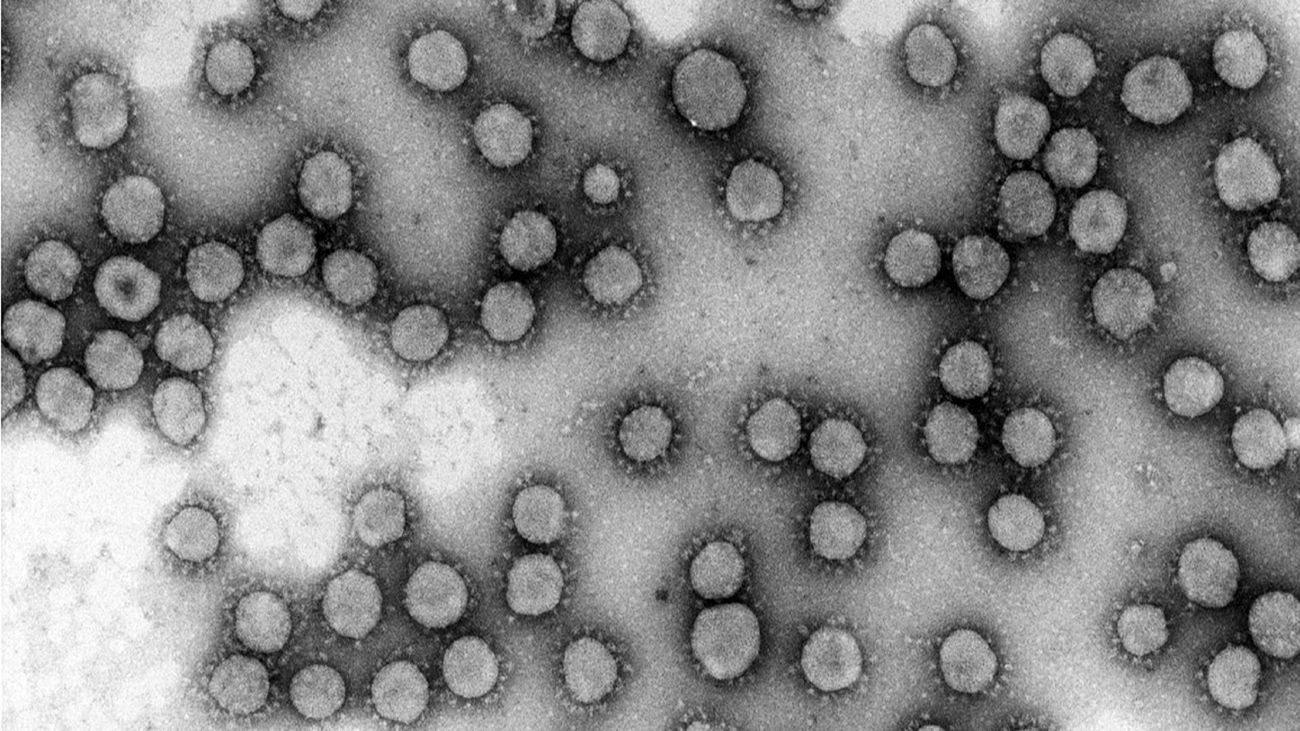 Imagen de un virus de la familia coronaviridae