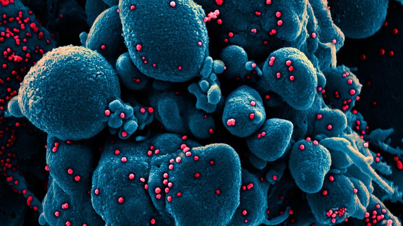 Célula (coloreada en azul) atacada por partículas (en rojo) del coronavirus