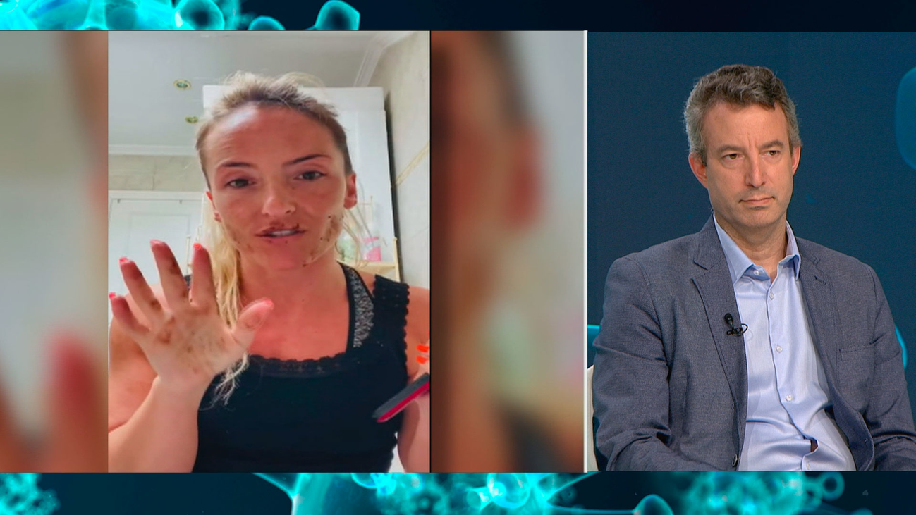 ¿Qué es la contaminación cruzada?