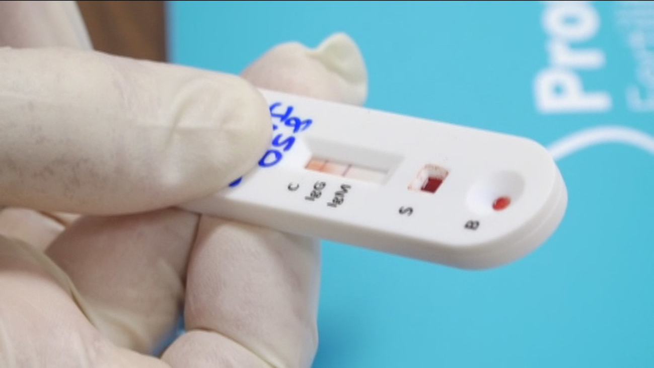 Tests 'express' para detectar el coronavirus por 59 euros en Madrid