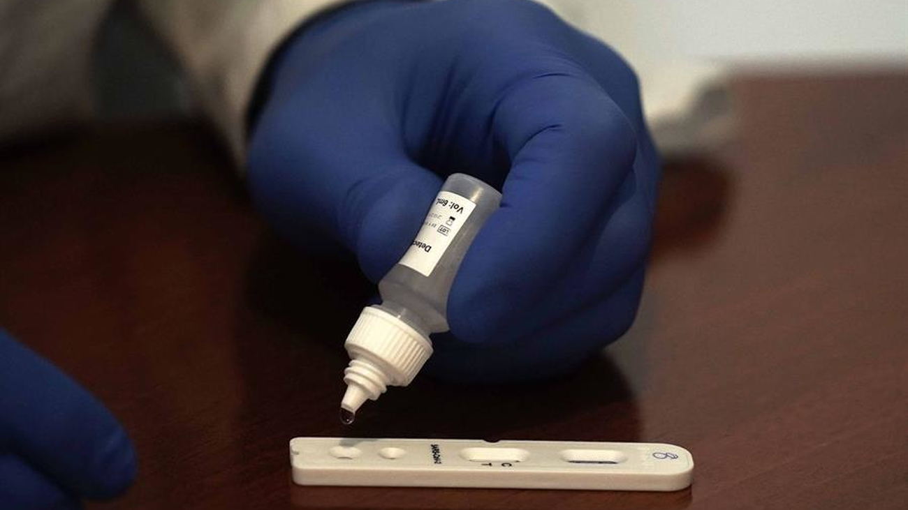 ¿Cómo se hace el estudio de seroprevalencia?