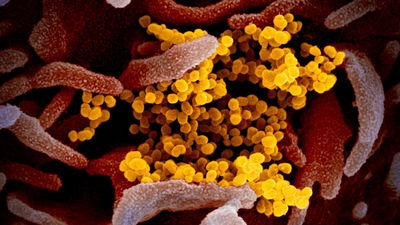 La OMS apunta al origen animal de SARS-CoV-2  tras su investigación en Wuhan