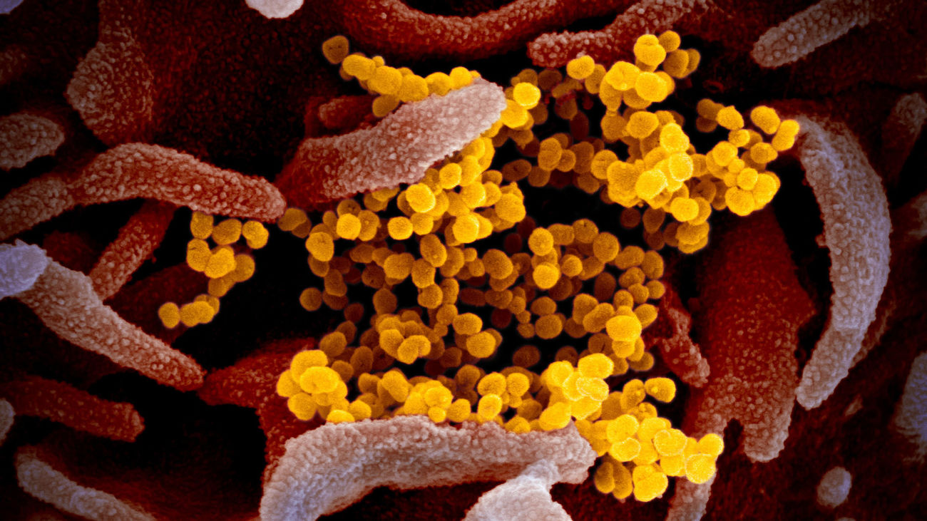 Imagen microscópica del SARS-CoV-2