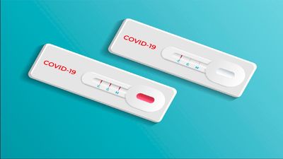 Los empadronados en Manzanares El Real podrán realizar test serológicos a 40 euros
