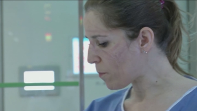 Los daños que las mascarillas originan en la piel