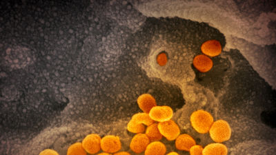 La supervivencia del coronavirus depende de humedad,  temperatura y superficie, según un estudio