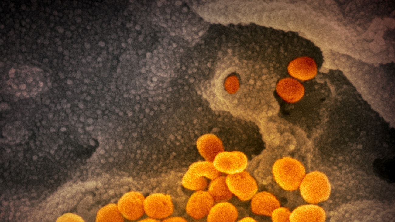 La supervivencia del coronavirus depende de humedad,  temperatura y superficie, según un estudio