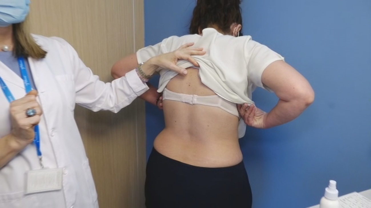 ¿Cómo detectar un lunar 'anómalo'?