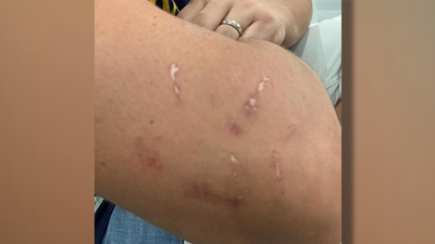 Un joven desnudo bajo los efectos de las drogas muerde a un policía local de Valdemoro