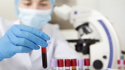 Javier Anguita: "Sabemos históricamente que el grupo sanguíneo influye en la respuesta a virus o bacterias"