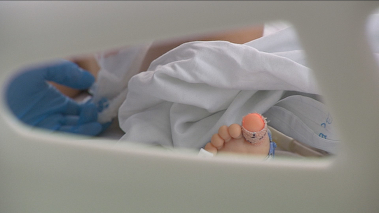 Así actúa el coronavirus en la piel de un niño