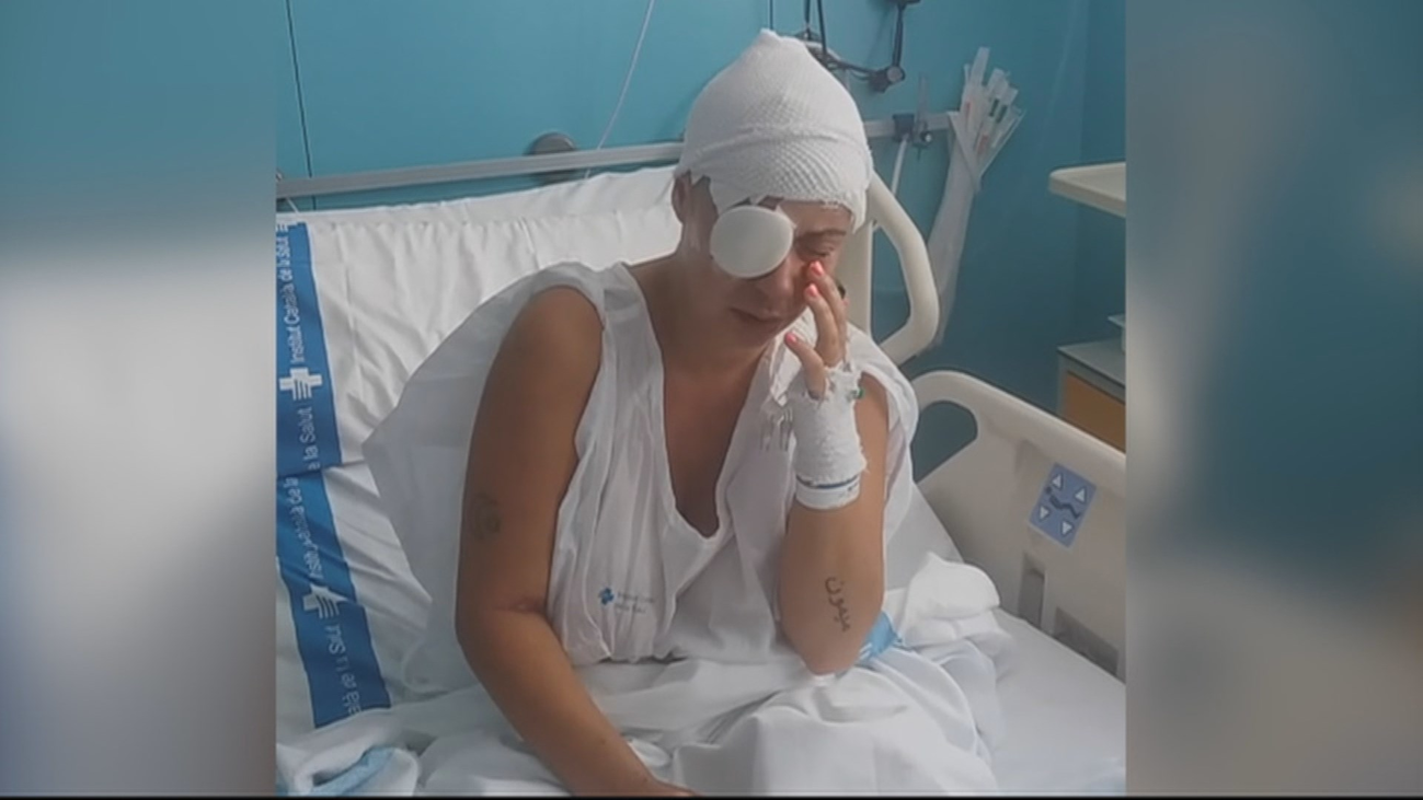 Un hombre rocía con sosa cáustica a una mujer y a su hija en Sant Feliu de Guíxols