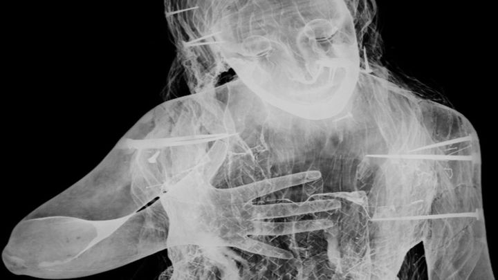 Juan de Mena. La Magdalena penitente (radiografía) / Museo Nacional del Prado