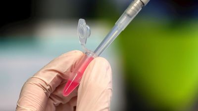 España podría tener en diciembre 3 millones de vacunas frente a la Covid-19