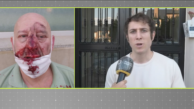 Brutalmente agredido por su vecino en Alpedrete