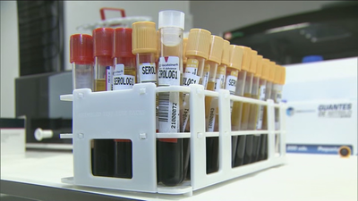 Aumenta el número de pruebas PCR en laboratorios y clínicas privadas antes de las vacaciones