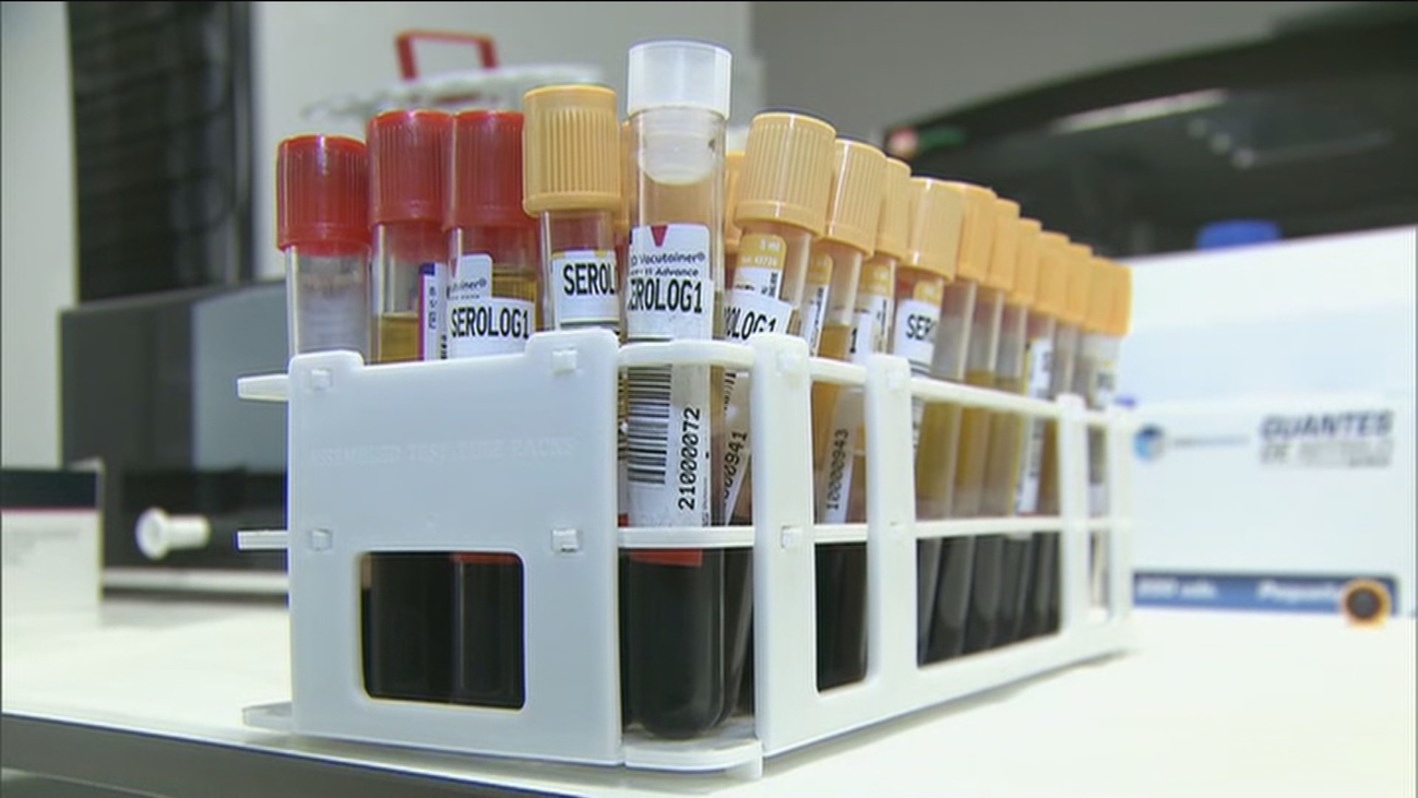 Aumenta el número de pruebas PCR en laboratorios y clínicas privadas antes de las vacaciones