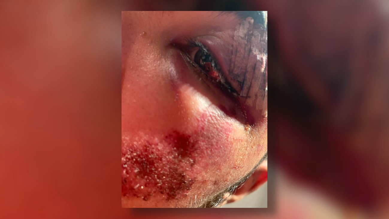 Brutal agresión a un joven en Hortaleza por negarse a dar un cigarrillo a tres menores